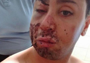 Joven denuncia golpiza homofóbica en Recoleta: "Por ir maquillado me dieron dos rodillazos en la cara"