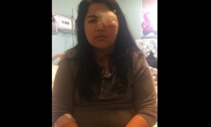 INDH se querella contra Carabineros por bomba lacrimógena que le hizo perder el ojo a joven estudiante mapuche
