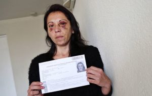 Registro Civil obliga a mujer víctima de violencia de género a renovar foto de carnet con lesiones en el rostro