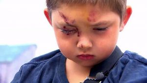 Niño autista fue a parar al hospital tras defender a su mejor amigo del bullying: "Yo solo les pedí que no lo hicieran"
