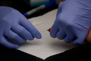 Jefa de Departamento de VIH renunció tras críticas por aumentos en los contagios