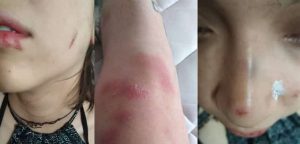 Pateadas en el suelo y azotadas contra la pared: Pareja de mujeres sufre brutal ataque en Barrio Bellavista