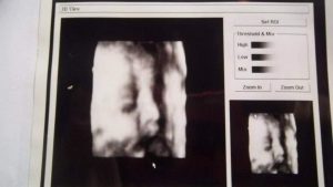 Ginecólogo que entregó la misma ecografía 3D a más de 40 mujeres embarazadas: "No existe engaño de mi parte"