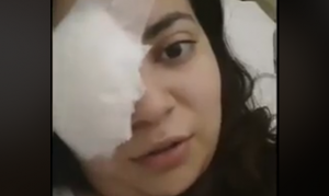 Enfermera que podría perder un ojo tras ataque de Carabineros: "Deseo de todo corazón que sigamos en la lucha"