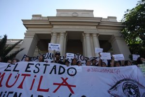 Hospital del Salvador confirma 280 lesionados con trauma ocular severo desde el comienzo de las manifestaciones