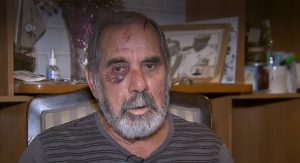 Habla abuelo agredido violentamente por Carabineros: “No había necesidad de seguir golpeándome”