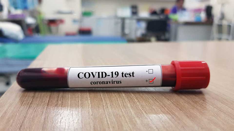 Nuevas formas de financiar el test de Covid-19