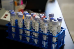 India anuncia su decisión de lanzar su vacuna contra el  COVID-19 "a más tardar el 15 de agosto"