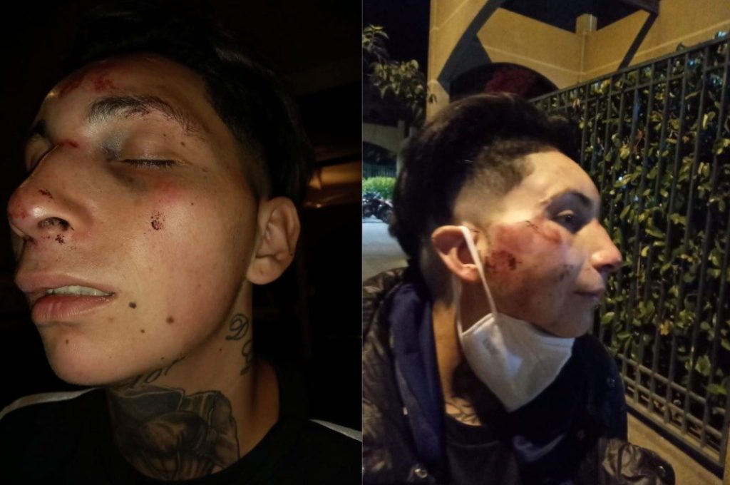 Ataque lesbofóbico: Mujer fue golpeada con un fierro hasta quedar inconsciente