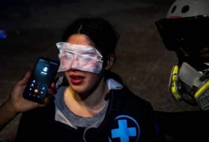 Profesora y brigadista de salud queda con ceguera temporal por ataque de Carabineros con gas pimienta