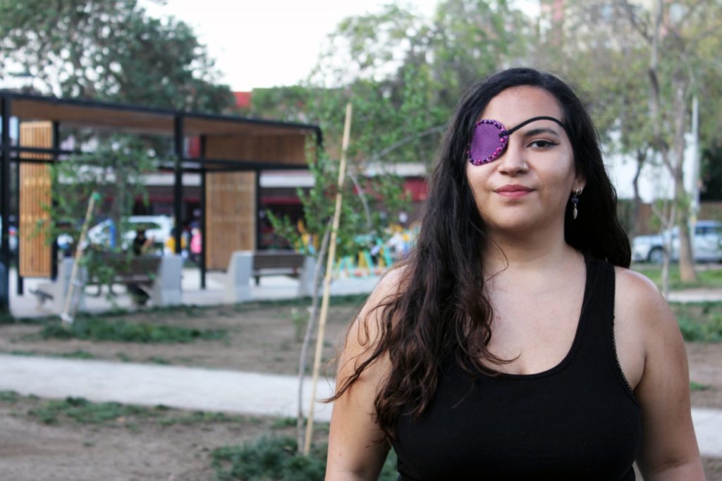 Natalia Aravena denuncia negligencias en programa de reparación ocular del gobierno: «Ustedes nos sacaron los ojos, háganse cargo»