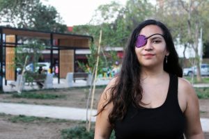 Natalia Aravena denuncia negligencias en programa de reparación ocular del gobierno: "Ustedes nos sacaron los ojos, háganse cargo"