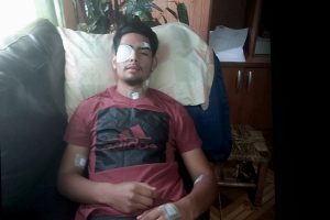 Cristián Millapan, joven mapuche víctima de trauma ocular: “Me dispararon directo a la cara”