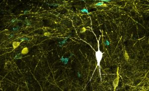 Actualizan base de datos con más de 120 neuronas del hipocampo
