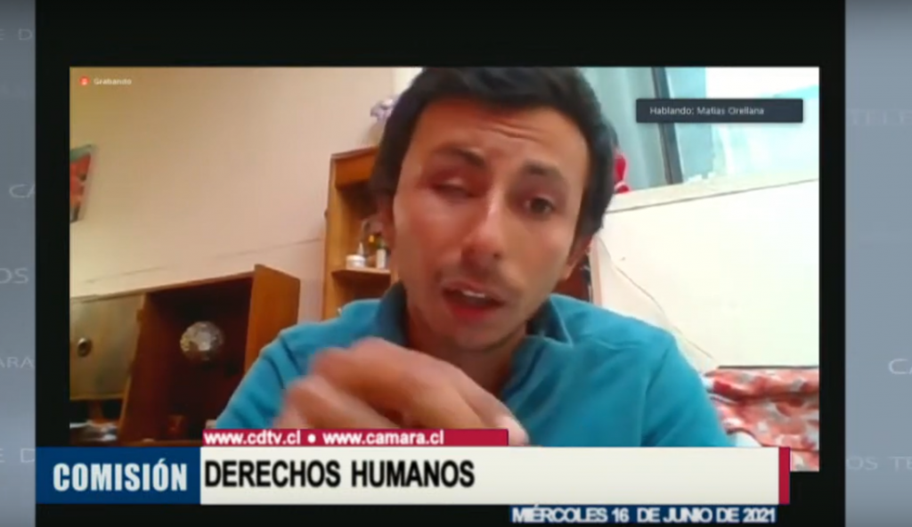 VIDEO| Matías Orellana, víctima de trauma ocular, ante la Cámara: “Pasan las comisiones y no hay ningún cambio”