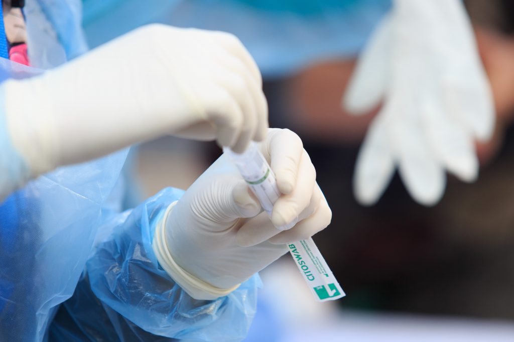 Coronavirus: Ministerio de Salud de Alemania confirma dos casos de la variante ómicron