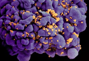 Una nueva variante más contagiosa del VIH lleva décadas circulando en Países Bajos