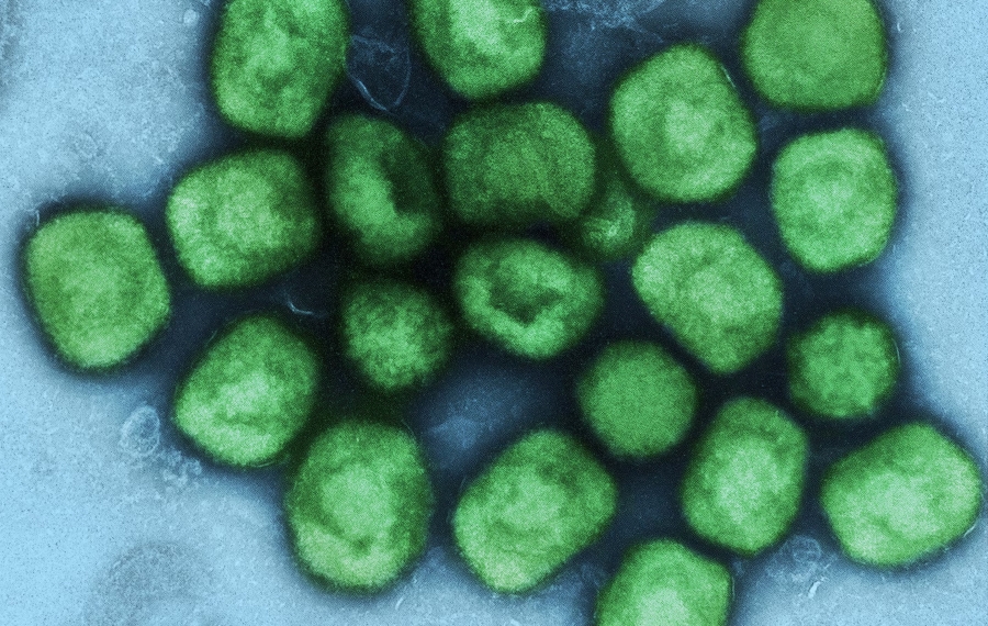 Minsal confirma casi 600 contagios de viruela del mono en el país