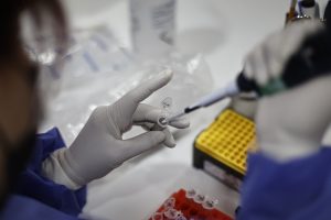 Viruela del mono: Subsecretario Ahumada dice que se están explorando opciones de vacunas