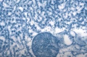 Henipavirus: Detectan en China 35 casos en humanos de una nueva patología de origen animal