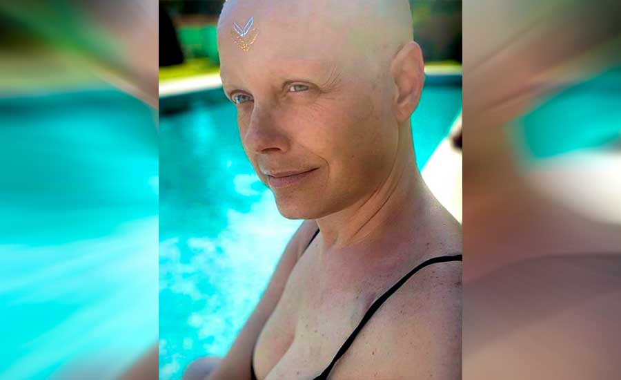 Revelan estado de salud de Claudia Conserva en medio de su ardua lucha contra el cáncer