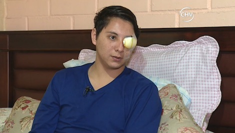 Joven pierde un ojo tras ataque homofóbico en el centro de Santiago