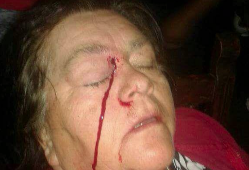 INDH se querellará contra Carabineros por mujer que perdió ojo por perdigón en medio de protestas en Villarrica