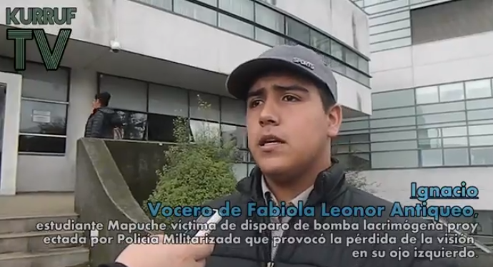 VIDEO| Vocero de joven que perdió ojo izquierdo tras ataque de Carabineros anuncia acciones legales