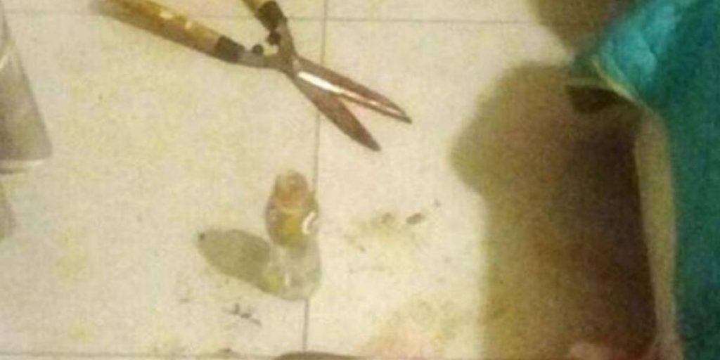 Aplicó la autodefensa: Mujer corta pene a hombre con tijera podadora tras ser presuntamente agredida