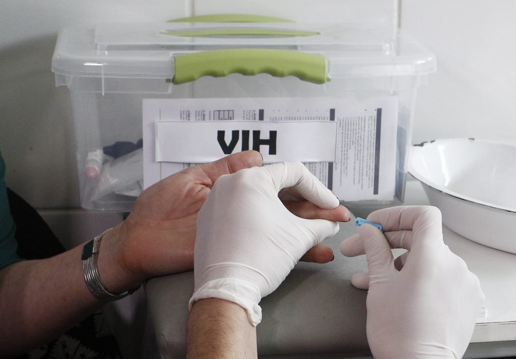 Casi 50 mil personas están contagiadas de VIH en Chile y no lo saben