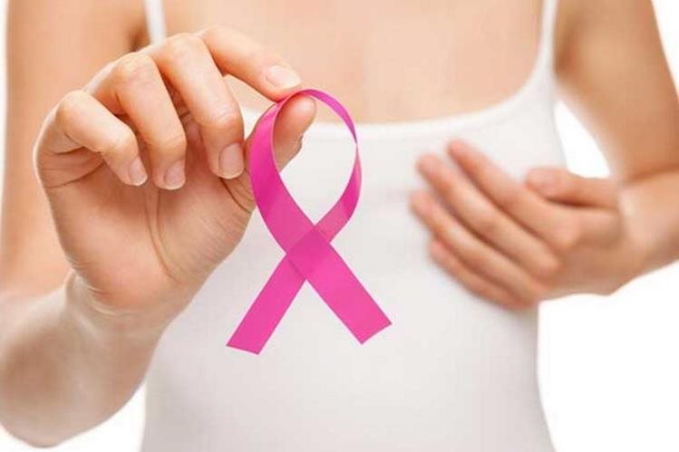 ¿Por qué es importante hacerse la mamografía? Tips sobre un procedimiento que puede salvar vidas