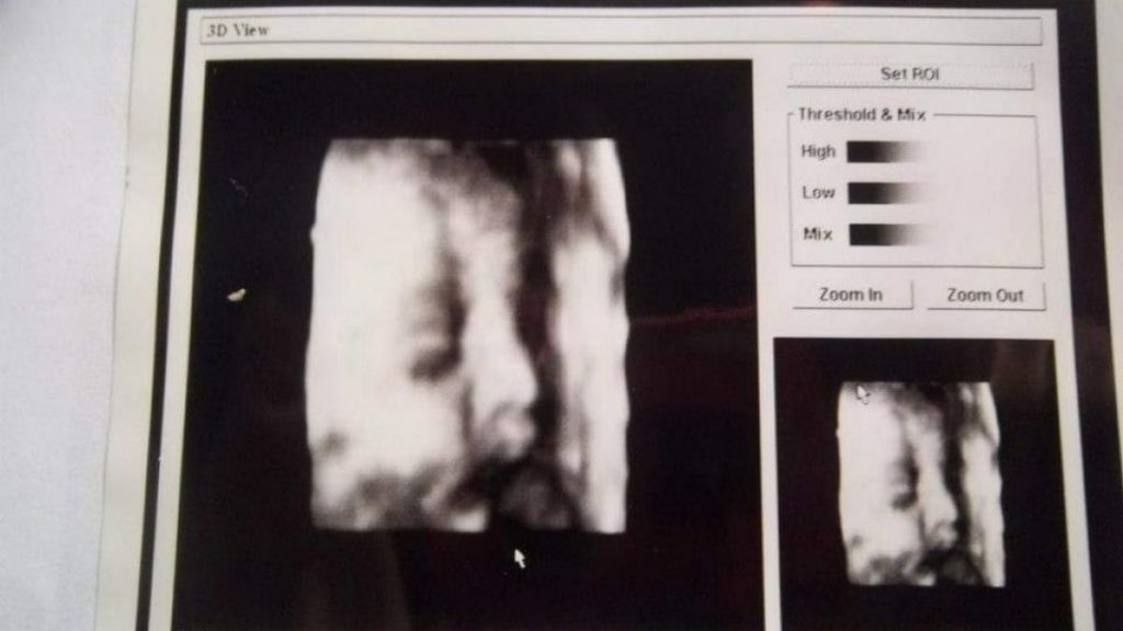 Ginecólogo que entregó la misma ecografía 3D a más de 40 mujeres embarazadas: «No existe engaño de mi parte»
