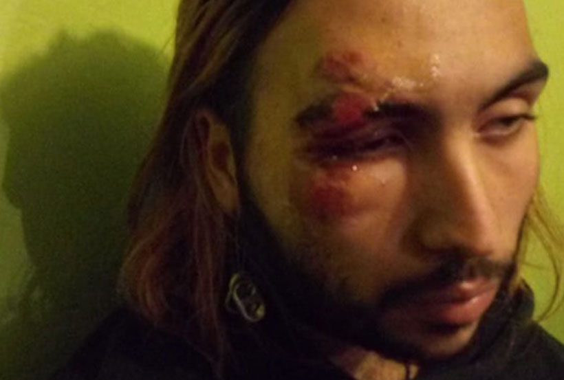 Joven es brutalmente golpeado por neonazis en Villa Alemana: Fue apuntado con una pistola