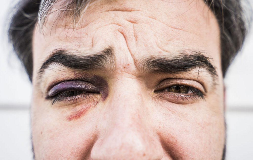 Chile: los ciegos que dejó la represión