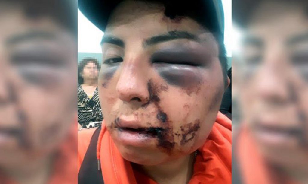 «Esto te pasa por maricón»: Joven sufre violento ataque homofóbico a manos de su hermana y su cuñado en Lo Espejo
