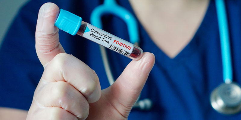 Científicos suizos admiten que podrían tener una vacuna definitiva contra el coronavirus en octubre