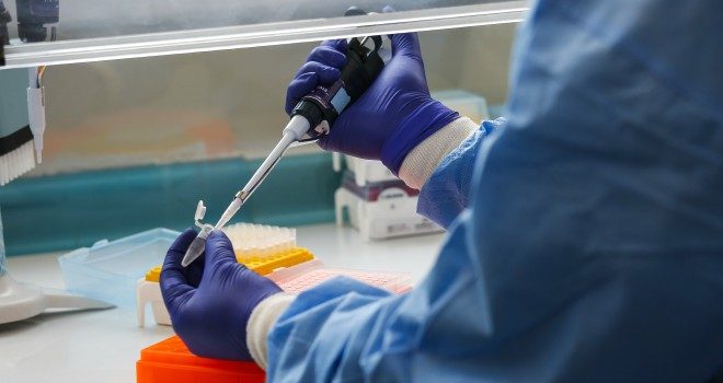 La Universidad de Oxford y AstraZeneca esperan tener en septiembre los resultados de su vacuna contra el COVID-19
