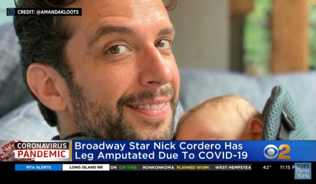 Conmoción en Estados Unidos por joven actor que perdió su pierna a causa del coronavirus
