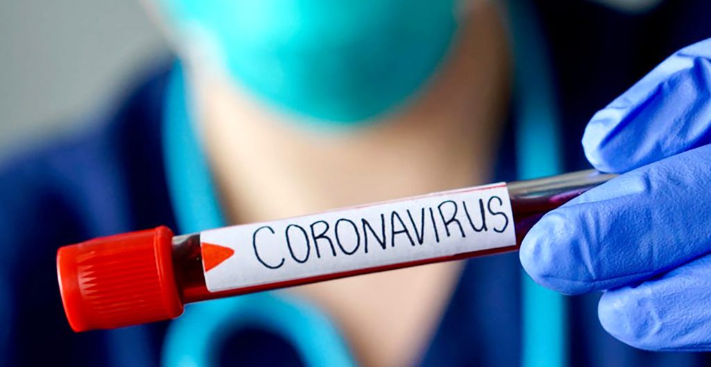 Jardinero de La Pintana muere de coronavirus tras contagiarse trabajando en el sector oriente de Santiago
